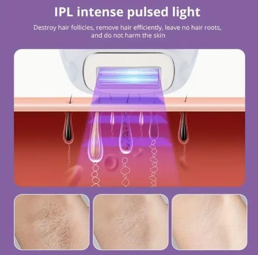 Hair Removal T013C Device Meets FDA510K Home Edition ( 5 level energy intensity)