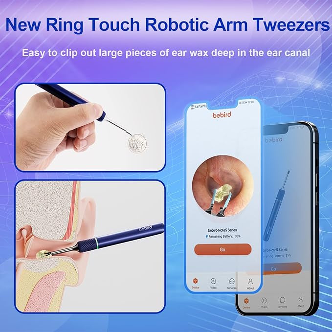 Bebird Note5 Pro Ear Wax Removal Tool Camera, Bebird Ear Cleaner, 10 Megapixel HD Otoscope with Light, Ear Camera with Tweezers 3-in-1, Spade Ear Cleaner for iPhone, Android(Blue)